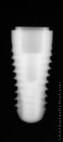 Radiograph of SPI Contact