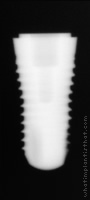 Radiograph of SPI Contact