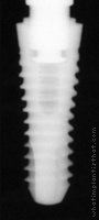 Radiograph of SPI Contact