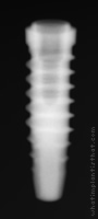 Radiograph of SPI Element