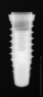 Radiograph of SPI Element