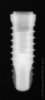 Radiograph of SPI Element