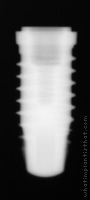 Radiograph of SPI Element