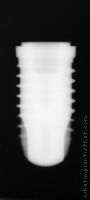 Radiograph of SPI Element