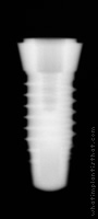 Radiograph of SPI Onetime