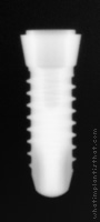 Radiograph of SPI Onetime
