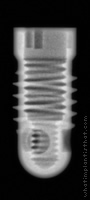 Radiograph of Screw-Cylinder