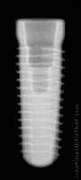 Radiograph of Conelog Screw-Line
