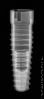 Radiograph of Screw-Line (J-Series)