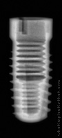 Radiograph of Screw-Line (J-Series)