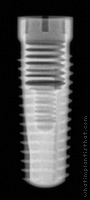 Radiograph of Screw-Line (J-Series)