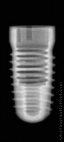 Radiograph of Screw-Line (J-Series)