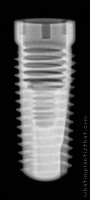 Radiograph of Screw-Line (J-Series)