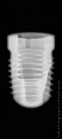 Radiograph of Screw-Line           (J-Series)