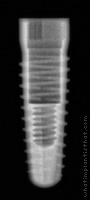 Radiograph of Screw-Line K-Series