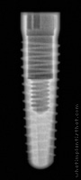 Radiograph of Screw-Line K-Series