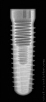 Radiograph of Screw-Line K-Series