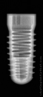 Radiograph of Screw-Line K-Series