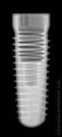 Radiograph of Screw-Line K-Series