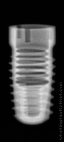 Radiograph of Screw-Line K-Series