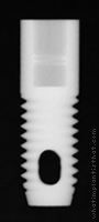 Radiograph of Screw Root Form