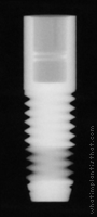 Radiograph of Screw Root Form