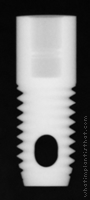 Radiograph of Screw Root Form