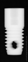 Radiograph of Screw Root Form