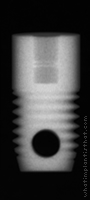 Radiograph of Screw Root Form