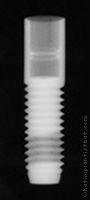 Radiograph of Screw Root Form