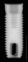 Radiograph of Screw -Vent