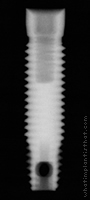 Radiograph of Screw -Vent
