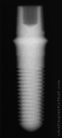 Radiograph of ScrewDirect