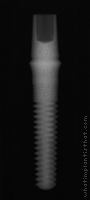 Radiograph of ScrewDirect
