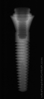 Radiograph of ScrewIndirect