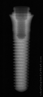 Radiograph of ScrewIndirect