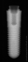 Radiograph of ScrewIndirect