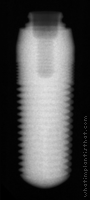 Radiograph of ScrewIndirect