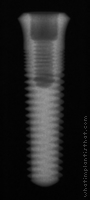 Radiograph of ScrewPlus