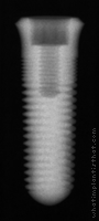 Radiograph of ScrewPlus