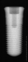 Radiograph of ScrewPlus