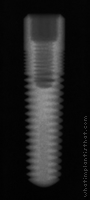 Radiograph of ScrewPlus