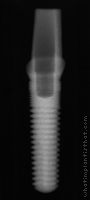 Radiograph of ScrewRedirect
