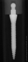 Radiograph of Sendax MDI Standard