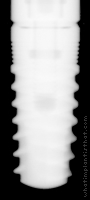 Radiograph of Seven (Wide Platform)