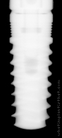 Radiograph of Seven (Wide Platform)
