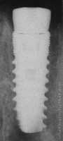 Radiograph of Seven (Wide Platform)