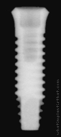Radiograph of Single-stage RBT, Laser-Lok