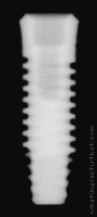 Radiograph of Single-stage RBT, Laser-Lok