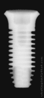 Radiograph of Single-stage RBT, Laser-Lok